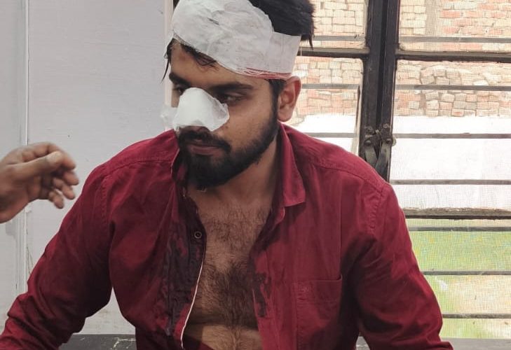 भाजपा नेता के भतीजे पर जानलेवा हमला, आरोपियों के खिलाफ मुकदमा दर्ज, फरार